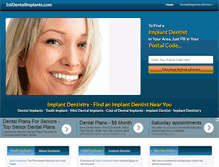 Tablet Screenshot of 1stdentalimplants.com